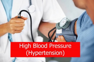 High blood pressure (Hypertension)